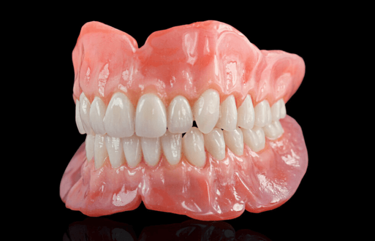 Complete Dentures